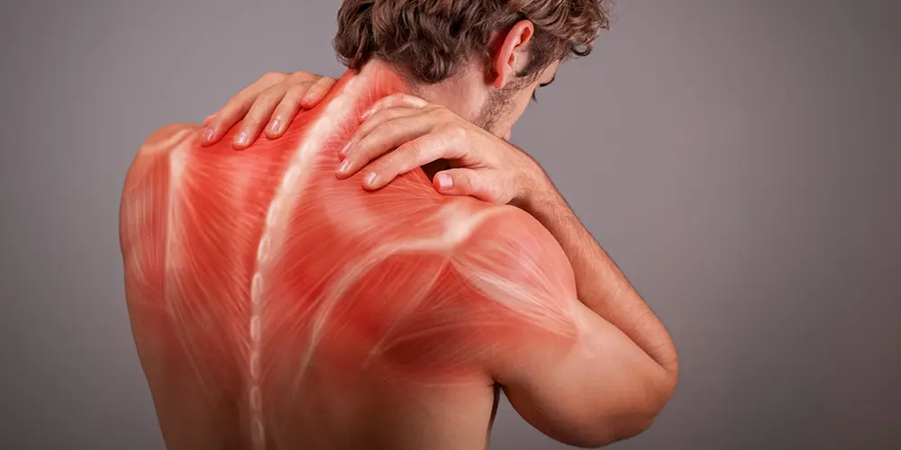 Myofascial Pain Syndrome Treatmen